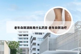 老年白斑消除用什么药膏 老年白斑治疗