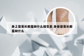 身上容易长癣是缺什么维生素 身体容易长癣是缺什么