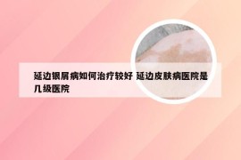 延边银屑病如何治疗较好 延边皮肤病医院是几级医院