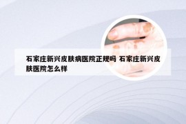 石家庄新兴皮肤病医院正规吗 石家庄新兴皮肤医院怎么样