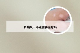 白癜风一小点需要治疗吗