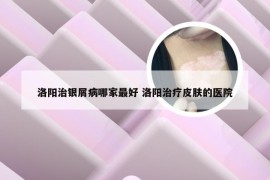 洛阳治银屑病哪家最好 洛阳治疗皮肤的医院