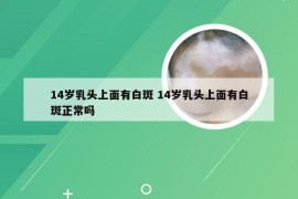 14岁乳头上面有白斑 14岁乳头上面有白斑正常吗