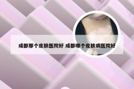 成都那个皮肤医院好 成都哪个皮肤病医院好