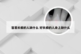 容易长癣的人缺什么 好长癣的人身上缺什么