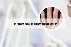 白斑病早期症 白斑病早期症状是什么