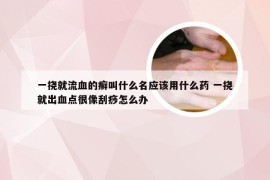 一挠就流血的癣叫什么名应该用什么药 一挠就出血点很像刮痧怎么办