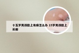 十五岁男孩脸上有癣怎么办 15岁男孩脸上长癣