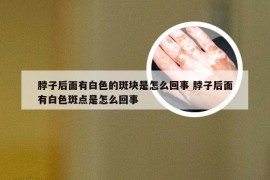 脖子后面有白色的斑块是怎么回事 脖子后面有白色斑点是怎么回事