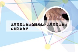 儿童屁股上有块白斑怎么办 儿童屁股上有块白斑怎么办啊