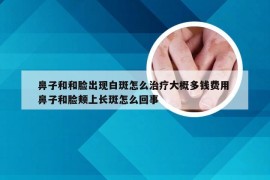 鼻子和和脸出现白斑怎么治疗大概多钱费用 鼻子和脸颊上长斑怎么回事