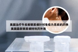 美国治疗牛皮癣银屑病针对免疫力系统的药物 美国最新银屑病特效药外用