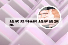 金健康可以治疗牛皮癣吗 金健康产品是正规的吗