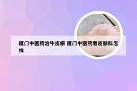 厦门中医院治牛皮癣 厦门中医院看皮肤科怎样