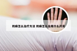 奶癣怎么治疗方法 奶癣怎么治用什么药膏