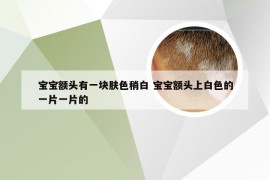 宝宝额头有一块肤色稍白 宝宝额头上白色的一片一片的