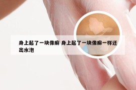 身上起了一块像癣 身上起了一块像癣一样还出水泡