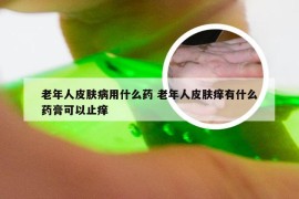 老年人皮肤病用什么药 老年人皮肤痒有什么药膏可以止痒