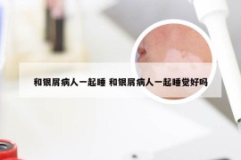 和银屑病人一起睡 和银屑病人一起睡觉好吗