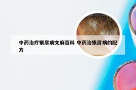 中药治疗银屑病文麻百科 中药治银屑病的配方