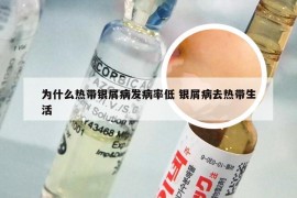 为什么热带银屑病发病率低 银屑病去热带生活