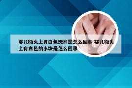 婴儿额头上有白色斑印是怎么回事 婴儿额头上有白色的小块是怎么回事