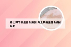 身上得了癣是什么原因 身上长癣是什么病引起的