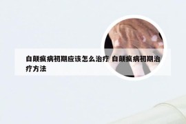 白颠疯病初期应该怎么治疗 白颠疯病初期治疗方法