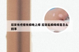 后背有疙瘩有癣晚上痒 后背起癣痒痒是怎么回事