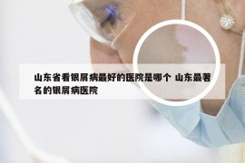 山东省看银屑病最好的医院是哪个 山东最著名的银屑病医院