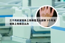 三个月的宝宝身上有癣是怎么回事 3个月宝宝身上有癣怎么办