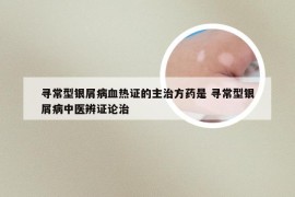 寻常型银屑病血热证的主治方药是 寻常型银屑病中医辨证论治