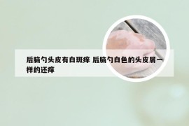 后脑勺头皮有白斑痒 后脑勺白色的头皮屑一样的还痒