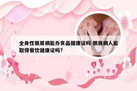 全身性银屑病能办食品健康证吗 银屑病人能取得餐饮健康证吗?