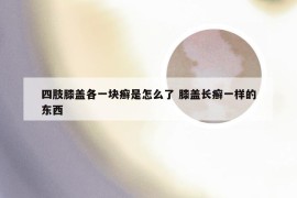 四肢膝盖各一块癣是怎么了 膝盖长癣一样的东西