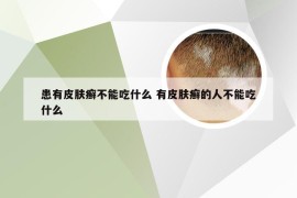 患有皮肤癣不能吃什么 有皮肤癣的人不能吃什么