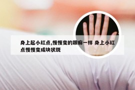 身上起小红点,慢慢变的跟癣一样 身上小红点慢慢变成块状斑