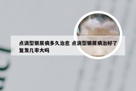 点滴型银屑病多久治愈 点滴型银屑病治好了复发几率大吗