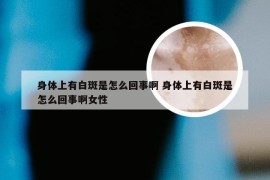 身体上有白斑是怎么回事啊 身体上有白斑是怎么回事啊女性