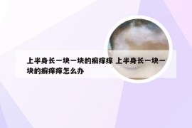 上半身长一块一块的癣痒痒 上半身长一块一块的癣痒痒怎么办