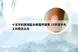 十五岁的男孩起头癣是咋回事 15岁孩子头上长癣怎么办