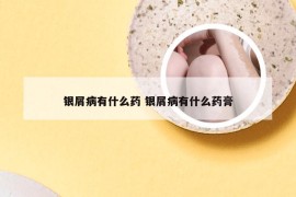 银屑病有什么药 银屑病有什么药膏