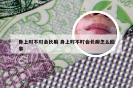 身上时不时会长癣 身上时不时会长癣怎么回事