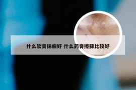 什么软膏抹癣好 什么药膏擦藓比较好