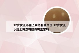 12岁女儿小腿上突然有些白斑 12岁女儿小腿上突然有些白斑正常吗