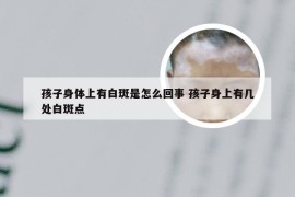 孩子身体上有白斑是怎么回事 孩子身上有几处白斑点