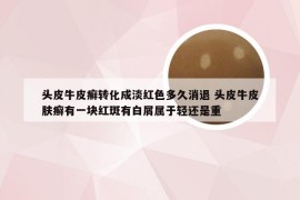 头皮牛皮癣转化成淡红色多久消退 头皮牛皮肤癣有一块红斑有白屑属于轻还是重