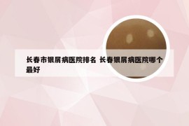 长春市银屑病医院排名 长春银屑病医院哪个最好