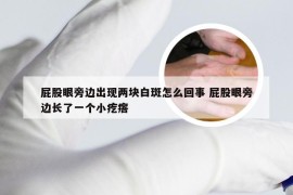 屁股眼旁边出现两块白斑怎么回事 屁股眼旁边长了一个小疙瘩