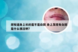 想知道身上长的是不是白斑 身上发现有白斑是什么情况啊?